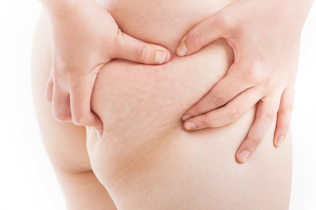 ヤーマンrfボーテ キャビスパ体験レポ 口コミ 効果など家庭用キャビテーションを比較検証 アンチエイジングの神様