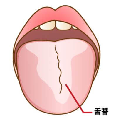 舌が白い 原因